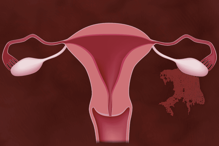Inside the uterus fertilisation
